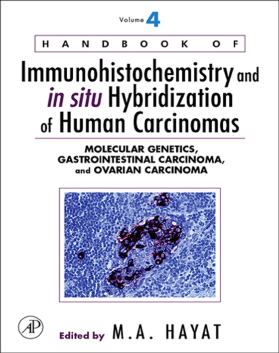 Handbook of Immunohistochemistry and in situ Hybridization of Human Carcinomas (e-bog) af -