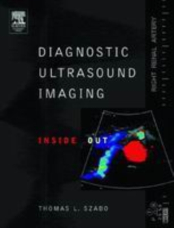 Diagnostic Ultrasound Imaging: Inside Out (e-bog) af Szabo, Thomas L.