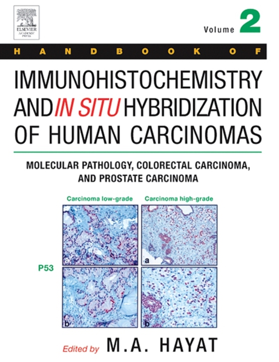 Handbook of Immunohistochemistry and in Situ Hybridization of Human Carcinomas (e-bog) af -