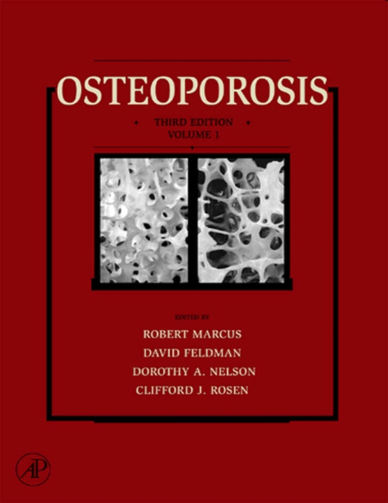 Osteoporosis (e-bog) af -