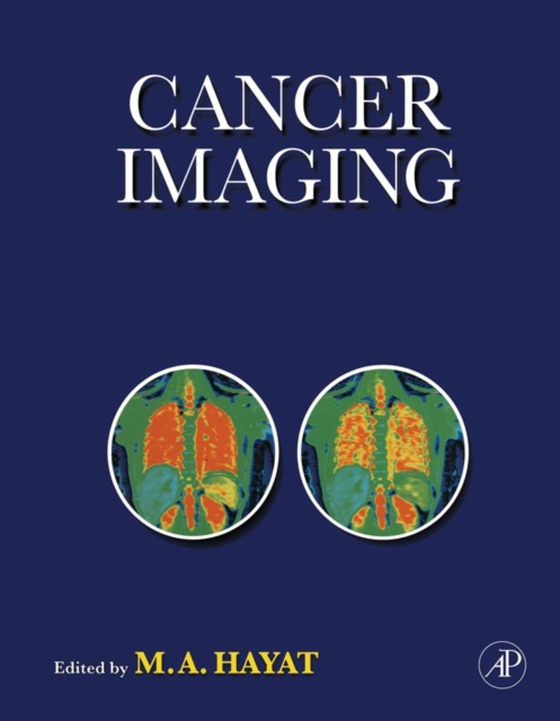 Cancer Imaging (e-bog) af Hayat, M. A.