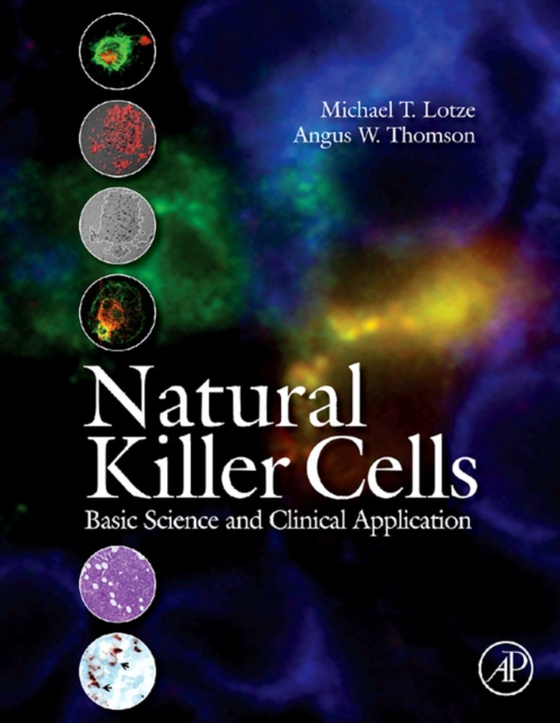 Natural Killer Cells