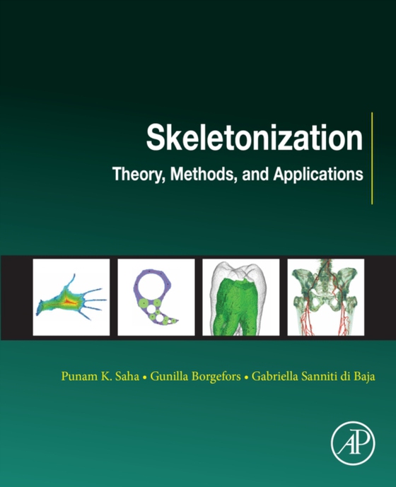 Skeletonization (e-bog) af -