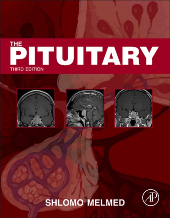 Pituitary (e-bog) af -