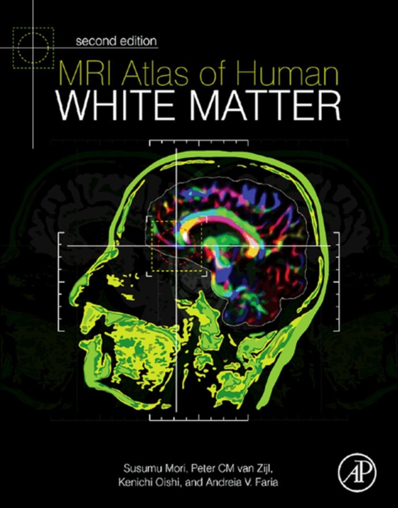 MRI Atlas of Human White Matter (e-bog) af Mori, Susumu