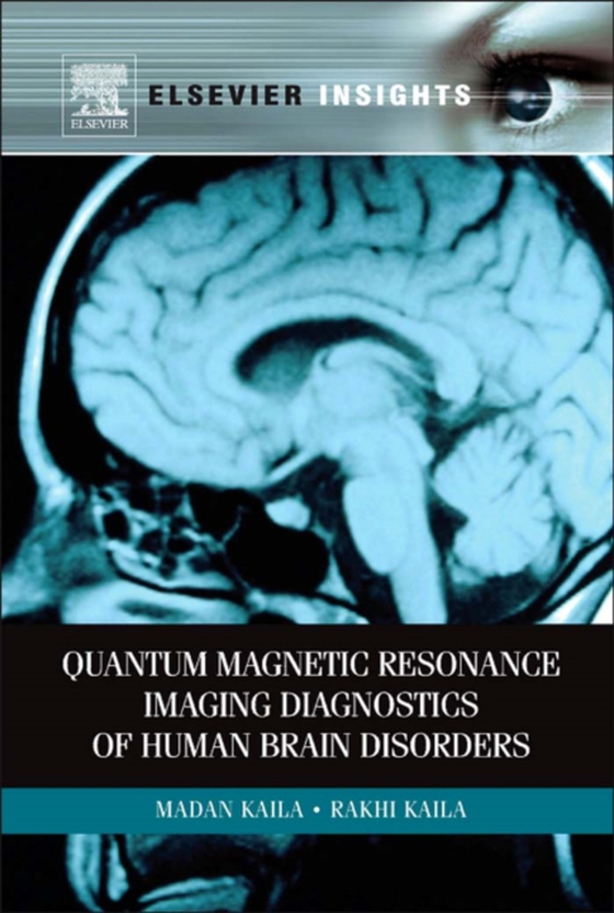 Quantum Magnetic Resonance Imaging Diagnostics of Human Brain Disorders (e-bog) af Kaila, Rakhi