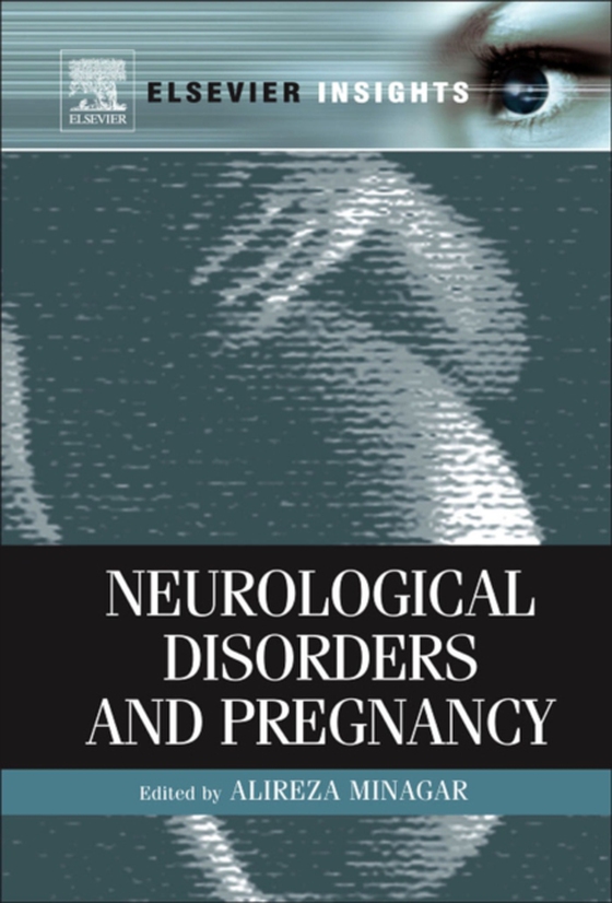 Neurological Disorders and Pregnancy (e-bog) af -