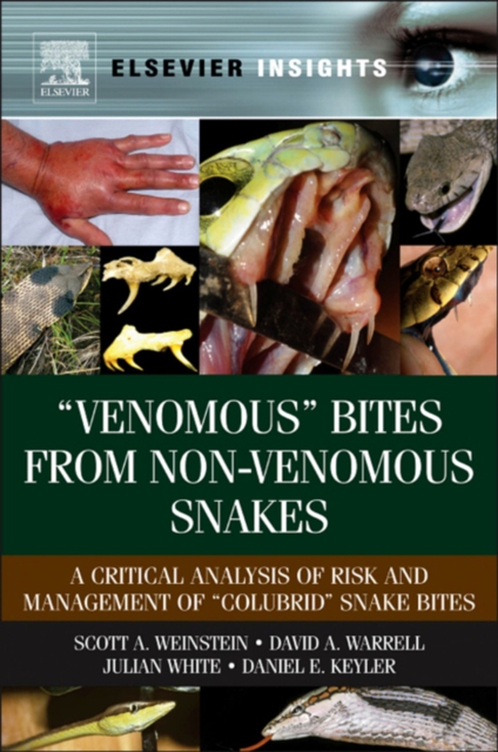 &quote;Venomous? Bites from Non-Venomous Snakes