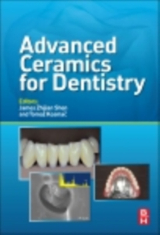 Advanced Ceramics for Dentistry (e-bog) af -