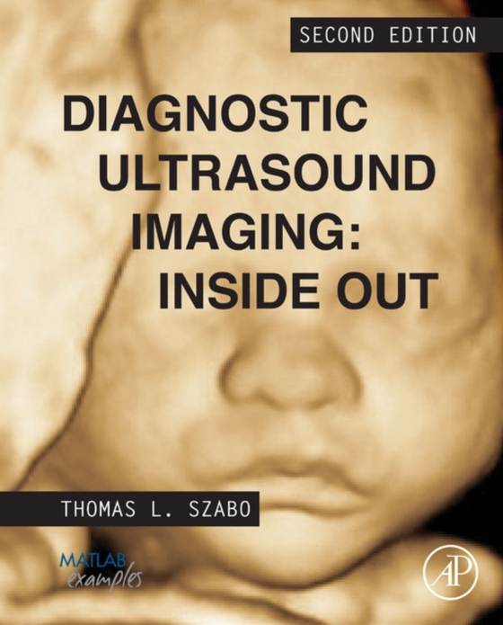 Diagnostic Ultrasound Imaging: Inside Out (e-bog) af Szabo, Thomas L.