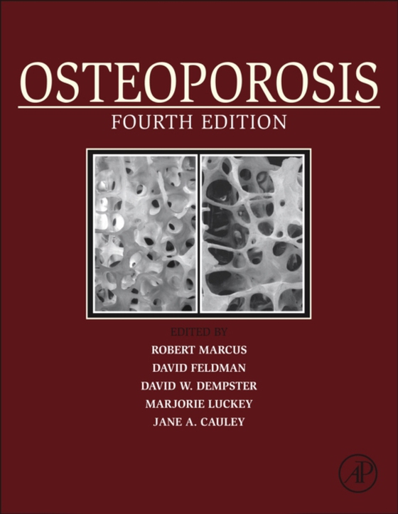 Osteoporosis