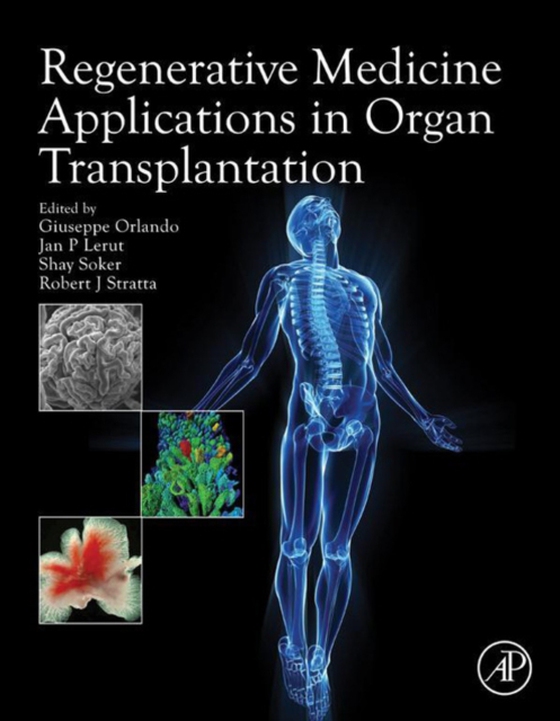 Regenerative Medicine Applications in Organ Transplantation (e-bog) af -