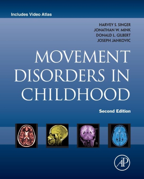 Movement Disorders in Childhood