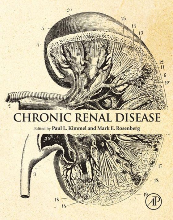 Chronic Renal Disease (e-bog) af -