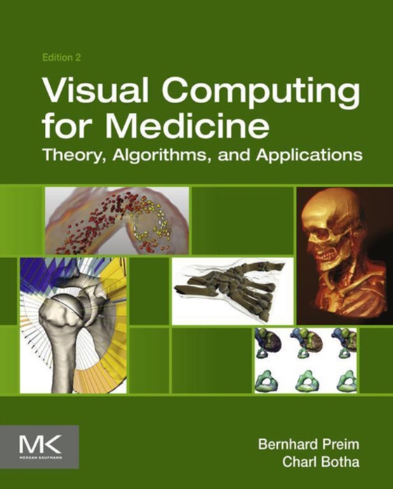 Visual Computing for Medicine (e-bog) af Botha, Charl P