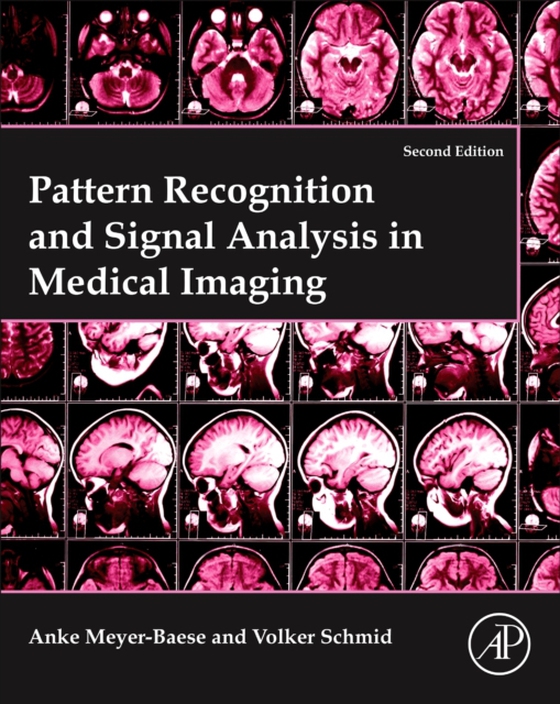 Pattern Recognition and Signal Analysis in Medical Imaging (e-bog) af Schmid, Volker J.