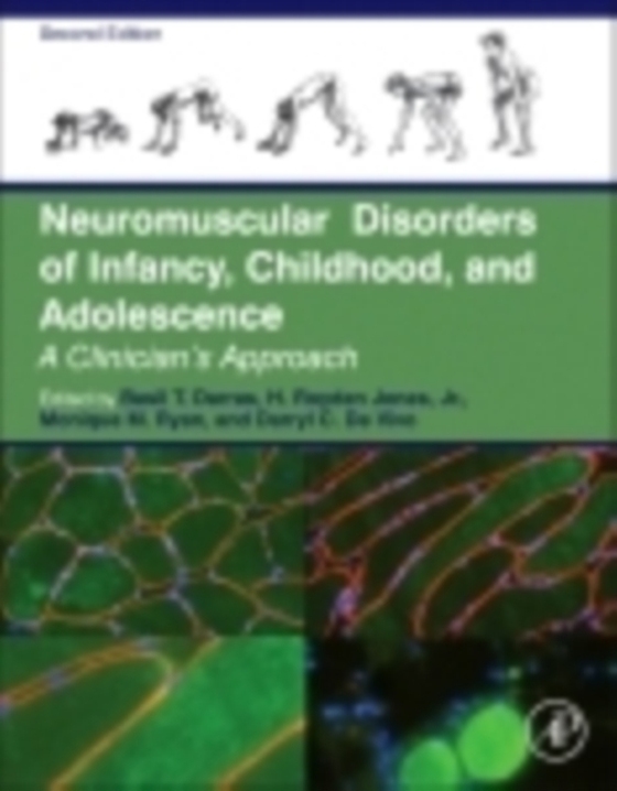 Neuromuscular Disorders of Infancy, Childhood, and Adolescence (e-bog) af -