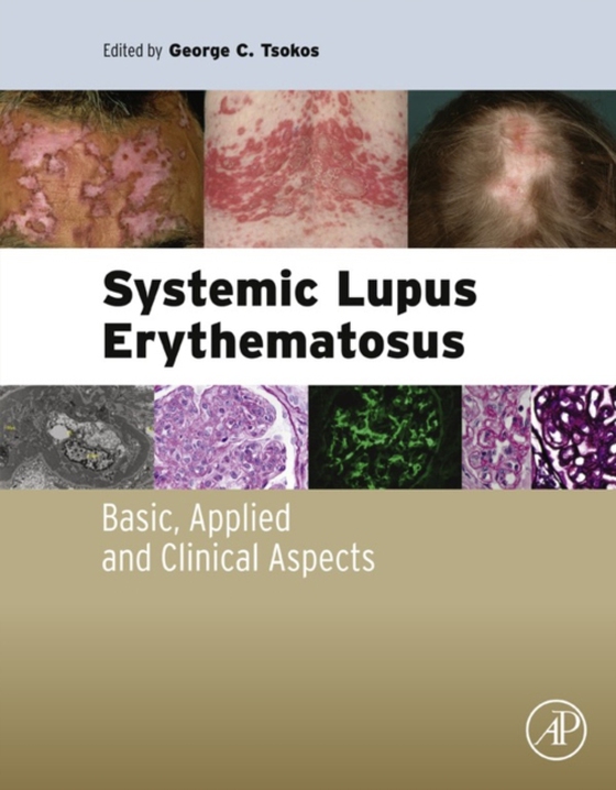 Systemic Lupus Erythematosus (e-bog) af -