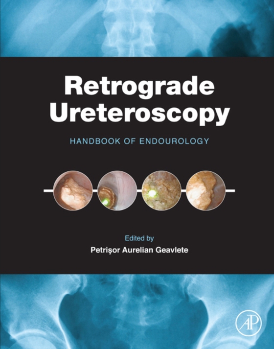 Retrograde Ureteroscopy (e-bog) af -