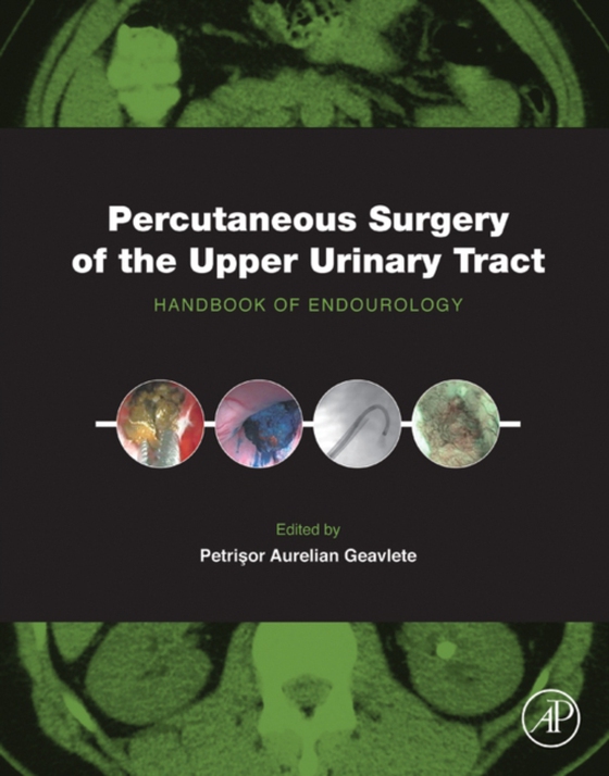 Percutaneous Surgery of the Upper Urinary Tract (e-bog) af -