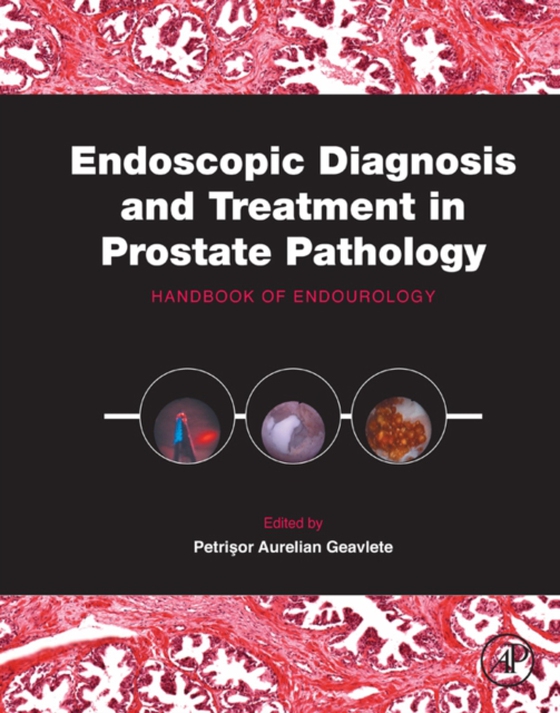 Endoscopic Diagnosis and Treatment in Prostate Pathology (e-bog) af -