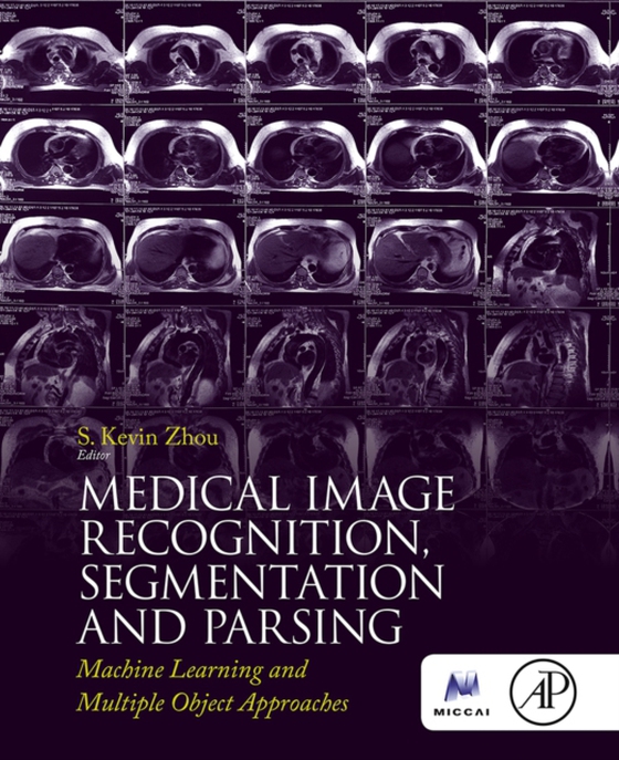 Medical Image Recognition, Segmentation and Parsing (e-bog) af Zhou, S. Kevin