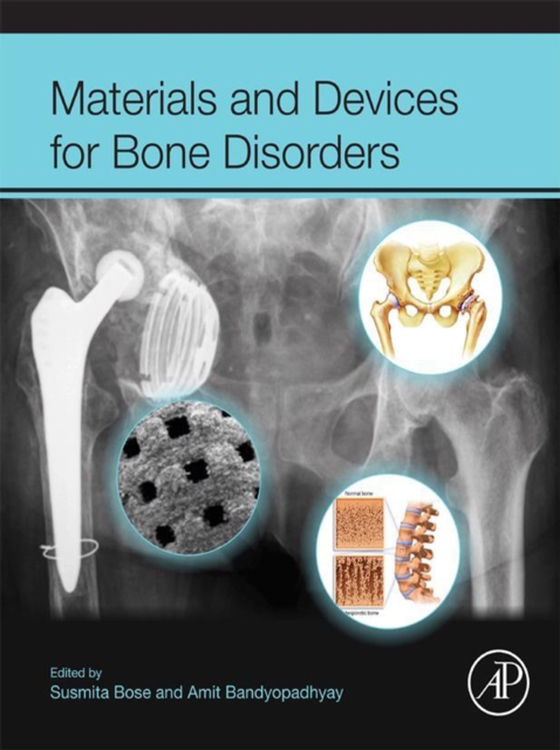 Materials and Devices for Bone Disorders (e-bog) af -