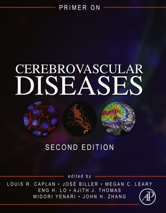 Primer on Cerebrovascular Diseases (e-bog) af -