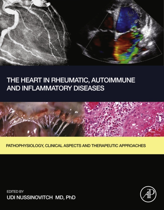 Heart in Rheumatic, Autoimmune and Inflammatory Diseases (e-bog) af -