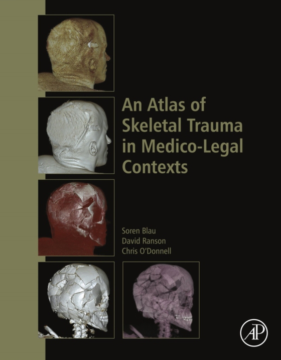 Atlas of Skeletal Trauma in Medico-Legal Contexts (e-bog) af O'Donnell, Chris