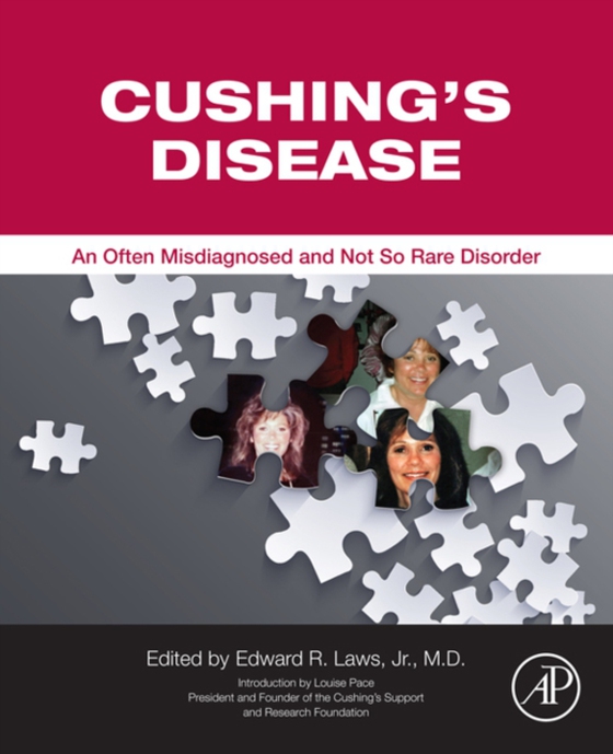 Cushing's Disease (e-bog) af -