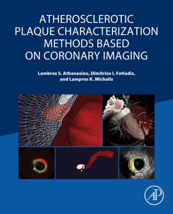 Atherosclerotic Plaque Characterization Methods Based on Coronary Imaging (e-bog) af Michalis, Lampros K