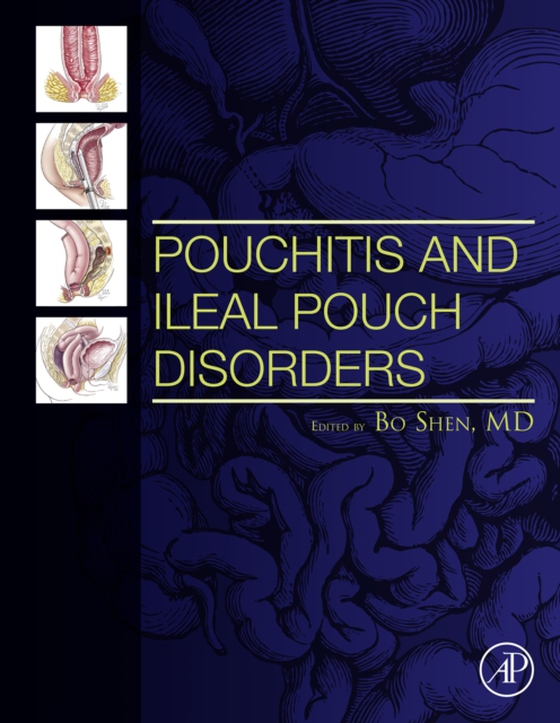 Pouchitis and Ileal Pouch Disorders (e-bog) af -