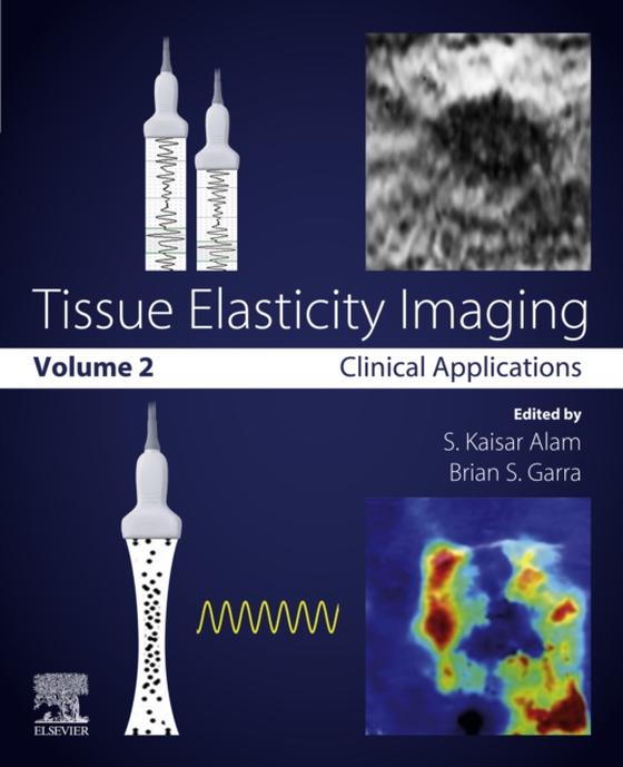 Tissue Elasticity Imaging (e-bog) af -