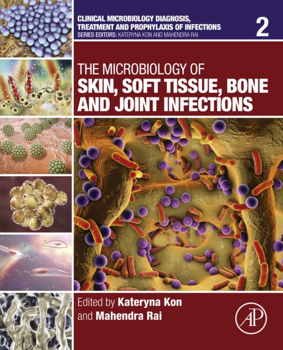 Microbiology of Skin, Soft Tissue, Bone and Joint Infections (e-bog) af -