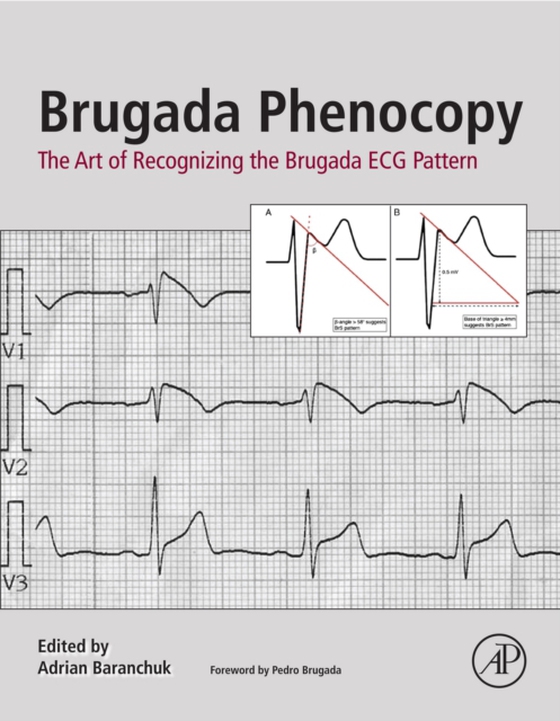 Brugada Phenocopy (e-bog) af -