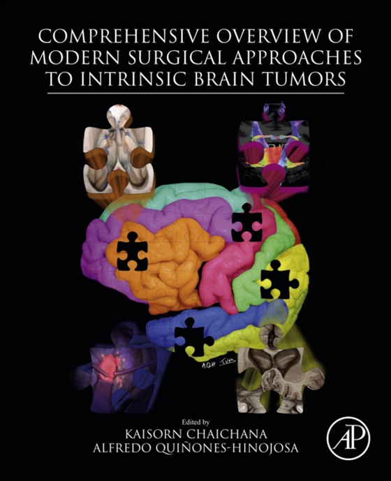 Comprehensive Overview of Modern Surgical Approaches to Intrinsic Brain Tumors (e-bog) af -