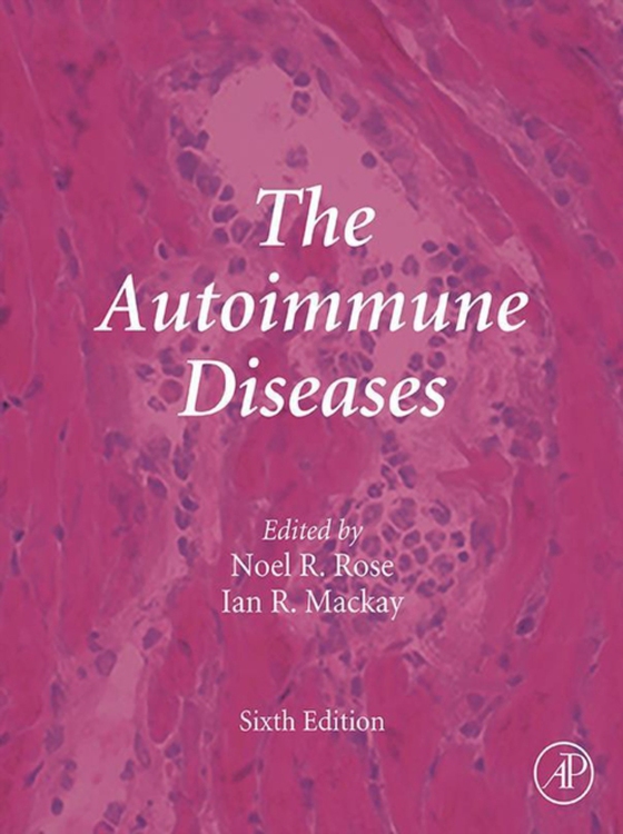 Autoimmune Diseases