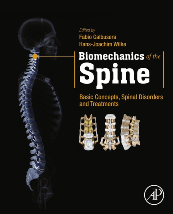 Biomechanics of the Spine (e-bog) af -