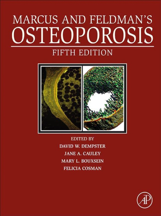 Marcus and Feldman's Osteoporosis (e-bog) af -