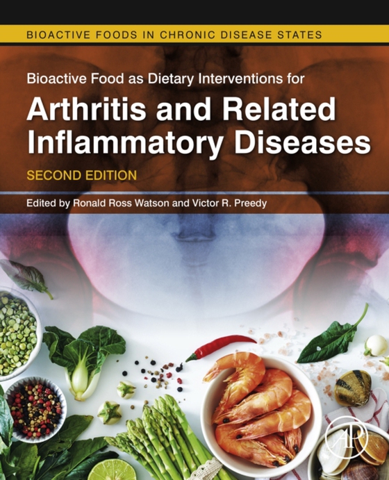 Bioactive Food as Dietary Interventions for Arthritis and Related Inflammatory Diseases (e-bog) af -