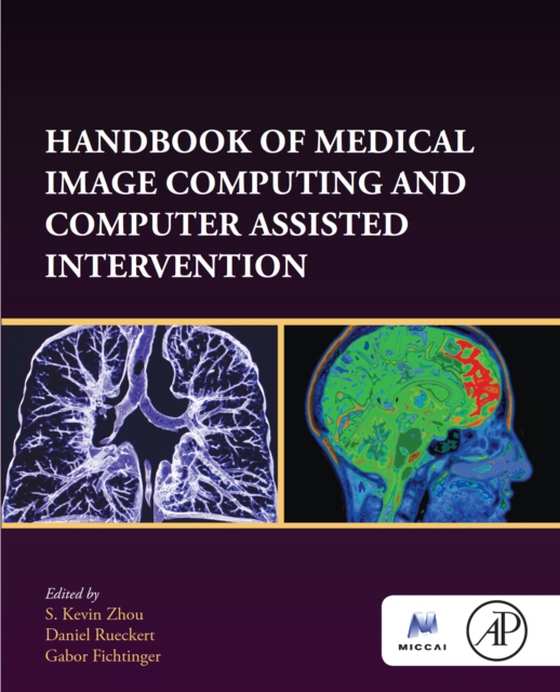 Handbook of Medical Image Computing and Computer Assisted Intervention (e-bog) af -