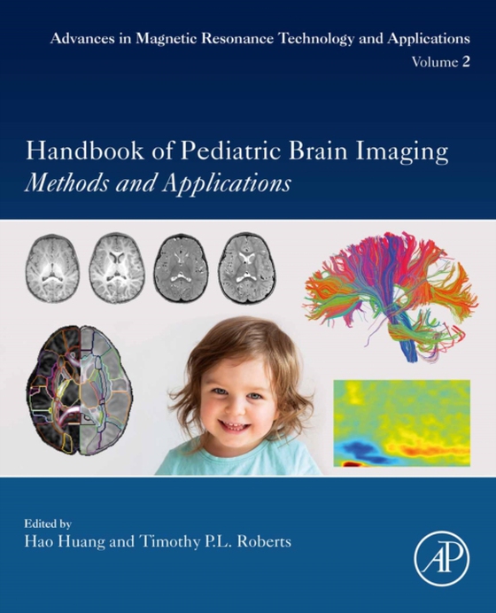 Handbook of Pediatric Brain Imaging (e-bog) af -