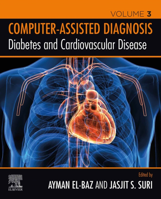 Diabetes and Cardiovascular Disease (e-bog) af -