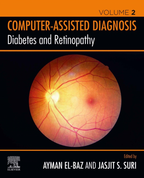 Diabetes and Retinopathy (e-bog) af -