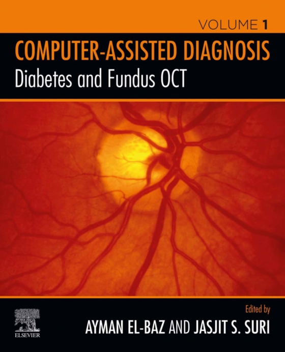 Diabetes and Fundus OCT (e-bog) af -