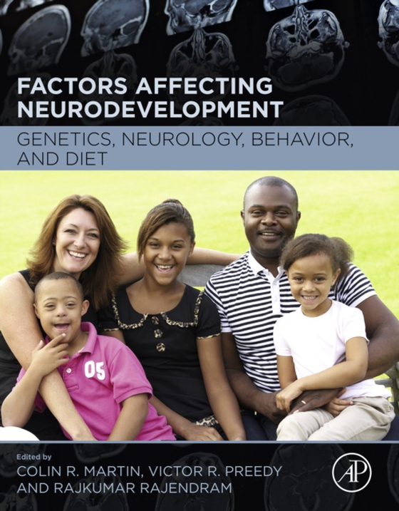 Factors Affecting Neurodevelopment (e-bog) af -