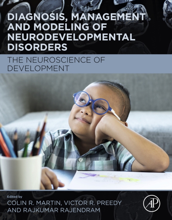Diagnosis, Management and Modeling of Neurodevelopmental Disorders (e-bog) af -