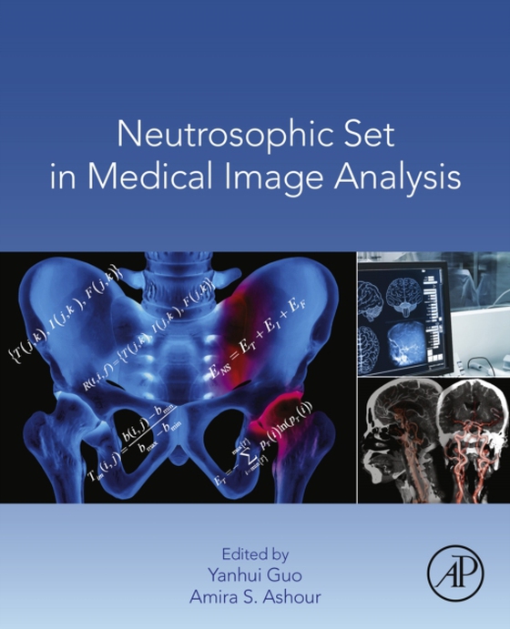 Neutrosophic Set in Medical Image Analysis (e-bog) af -