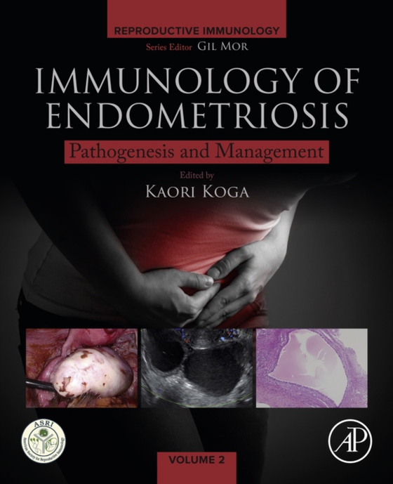 Immunology of Endometriosis (e-bog) af -